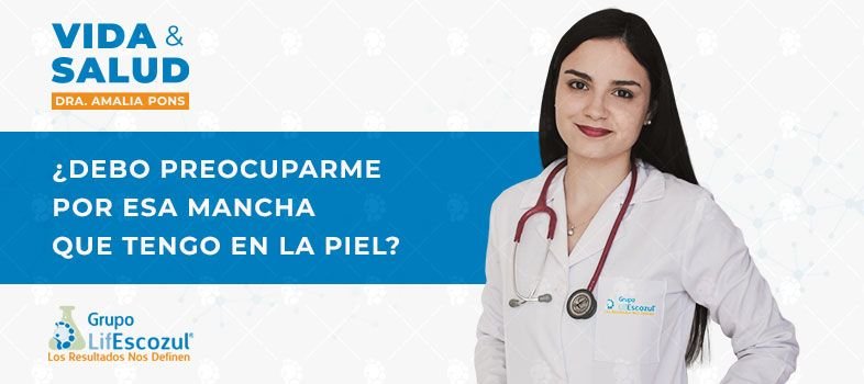 ¿Debo preocuparme por esa mancha que tengo en la piel?