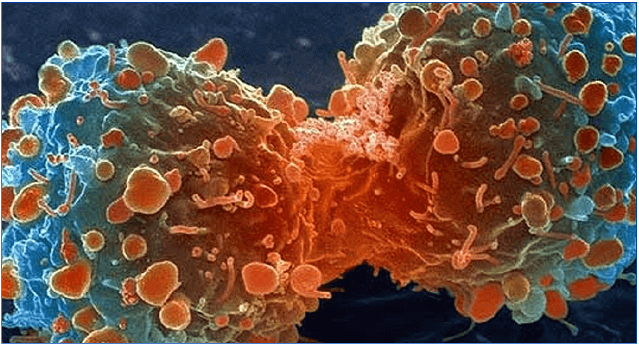 ¿Qué es el cáncer?