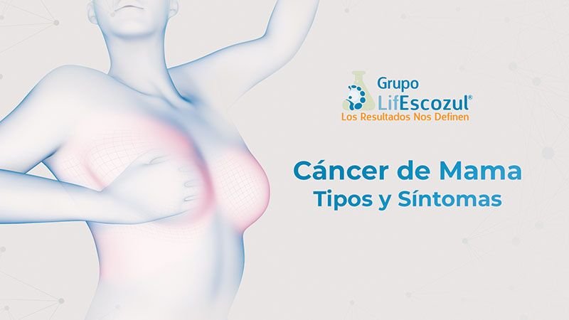 Cáncer de Mama: tipos y síntomas