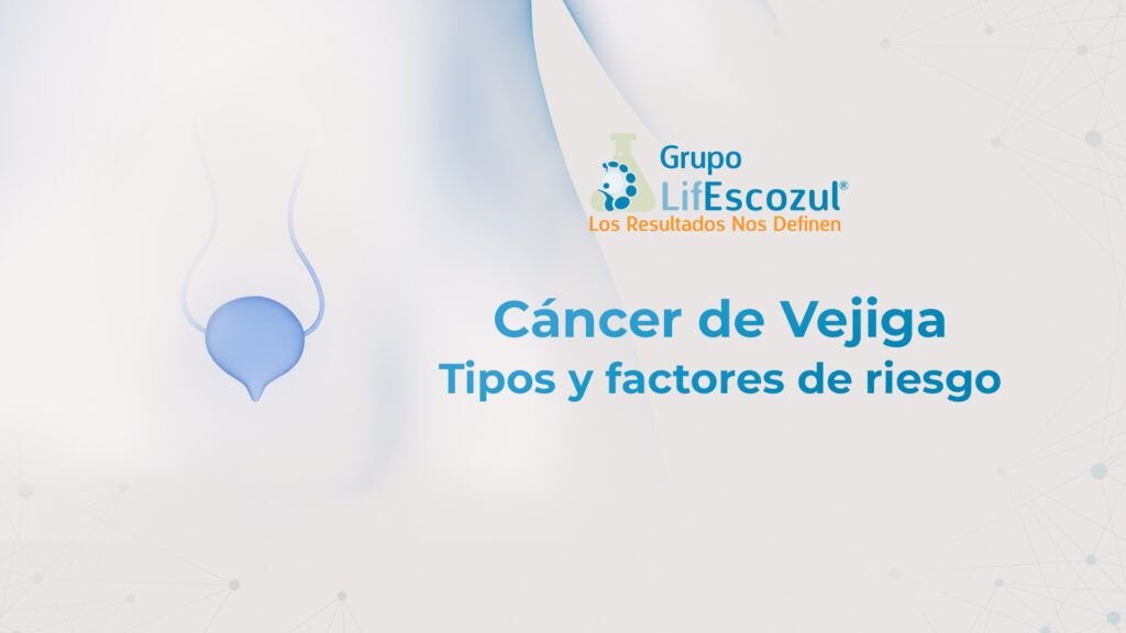 Cáncer de Vejiga, tipos y factores de riesgo