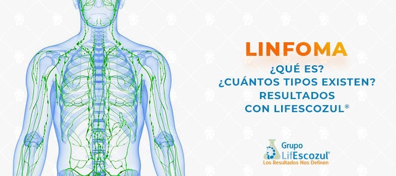 ¿Qué es el linfoma?