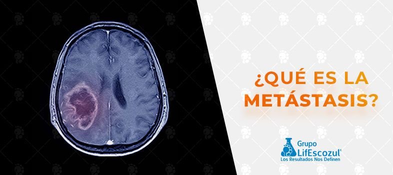 ¿Qué es la Metástasis?