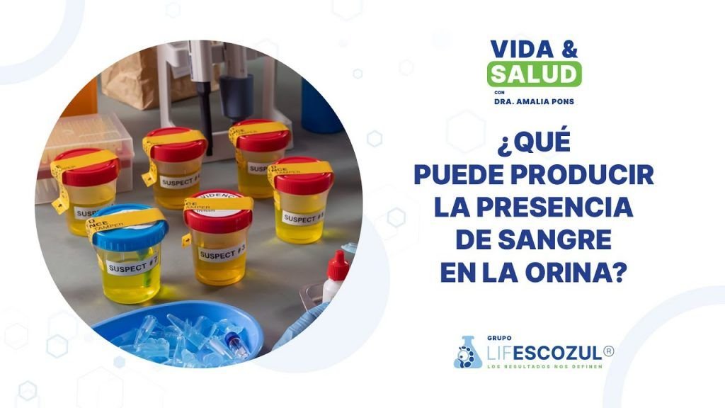 ¿Qué puede producir la presencia de sangre en la orina?
