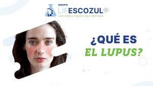 que-es-el-lupus-grupo-lifescozul