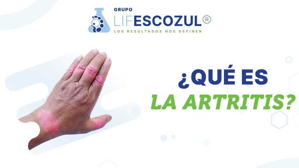 ¿Qué es la Artritis?