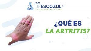 que-es-la-artritis-grupo-lifesczozul