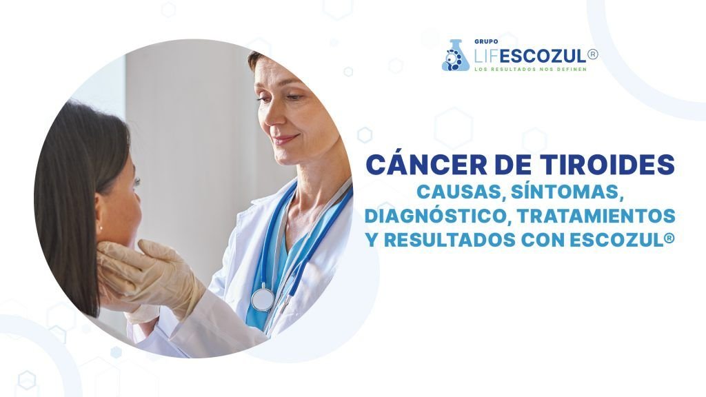 Cáncer de Tiroides: causas, síntomas, diagnóstico, tratamientos y resultados con Escozul®